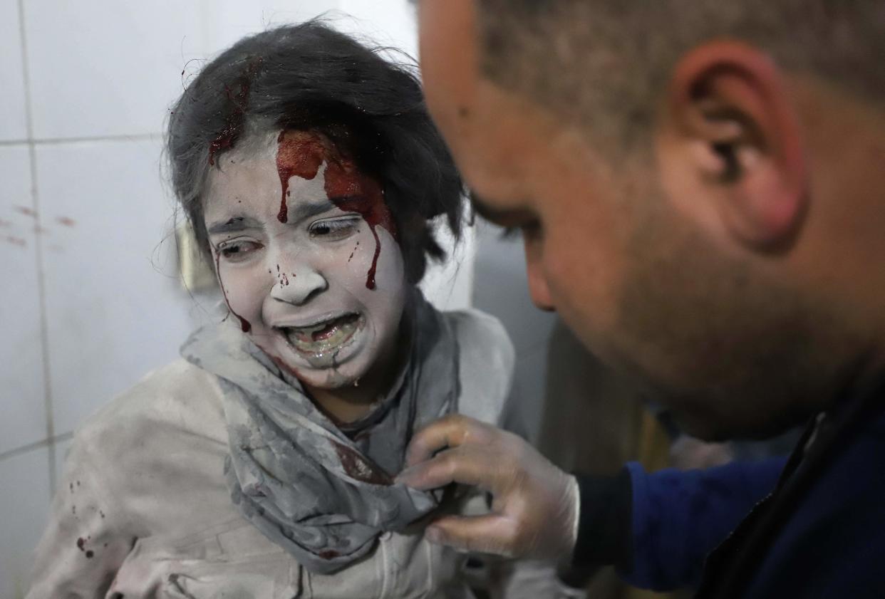 A Syrian girl receives treatment in a makeshift hospital (AFP via Getty Images)