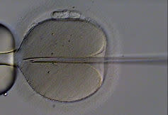 <span class="caption">ICSI sperm injection into oocyte.</span> <span class="attribution"><a class="link " href="https://en.wikipedia.org/wiki/File:ICSI.jpg" rel="nofollow noopener" target="_blank" data-ylk="slk:Eugene Ermolovich (CRMI);elm:context_link;itc:0;sec:content-canvas">Eugene Ermolovich (CRMI)</a>, <a class="link " href="http://creativecommons.org/licenses/by-sa/4.0/" rel="nofollow noopener" target="_blank" data-ylk="slk:CC BY-SA;elm:context_link;itc:0;sec:content-canvas">CC BY-SA</a></span>