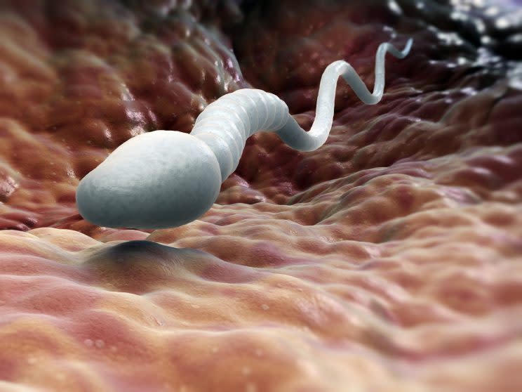 Un semen saludable se determina por la cantidad, calidad y movimiento del espermatozoide. (Foto: Getty)
