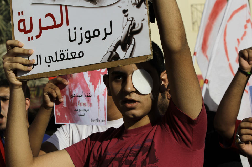 Bahraini anti-government protester Mohamed al-Jazeeri, 16, who said he lost his left eye during previous clashes, raises a sign reading, "Freedom to our symbols, prisoners of conscience," referring to jailed opposition leaders Thursday, June 7, 2012, in Sitra, Bahrain. The sign behind reads, "Save Ahmed Oun," in English and Arabic, and "Freedom for the injured, imprisoned Ahmed Oun." Human rights activists say Oun was jailed after being shot in the face with birdshot and allege he is at risk of losing an eye if he does not receive proper treatment in jail. Clashes erupted after the march to recognize protesters who have lost their vision after being shot in the eye with bird shot, rubber bullets or tear gas canisters during past clashes. (AP Photo/Hasan Jamali)