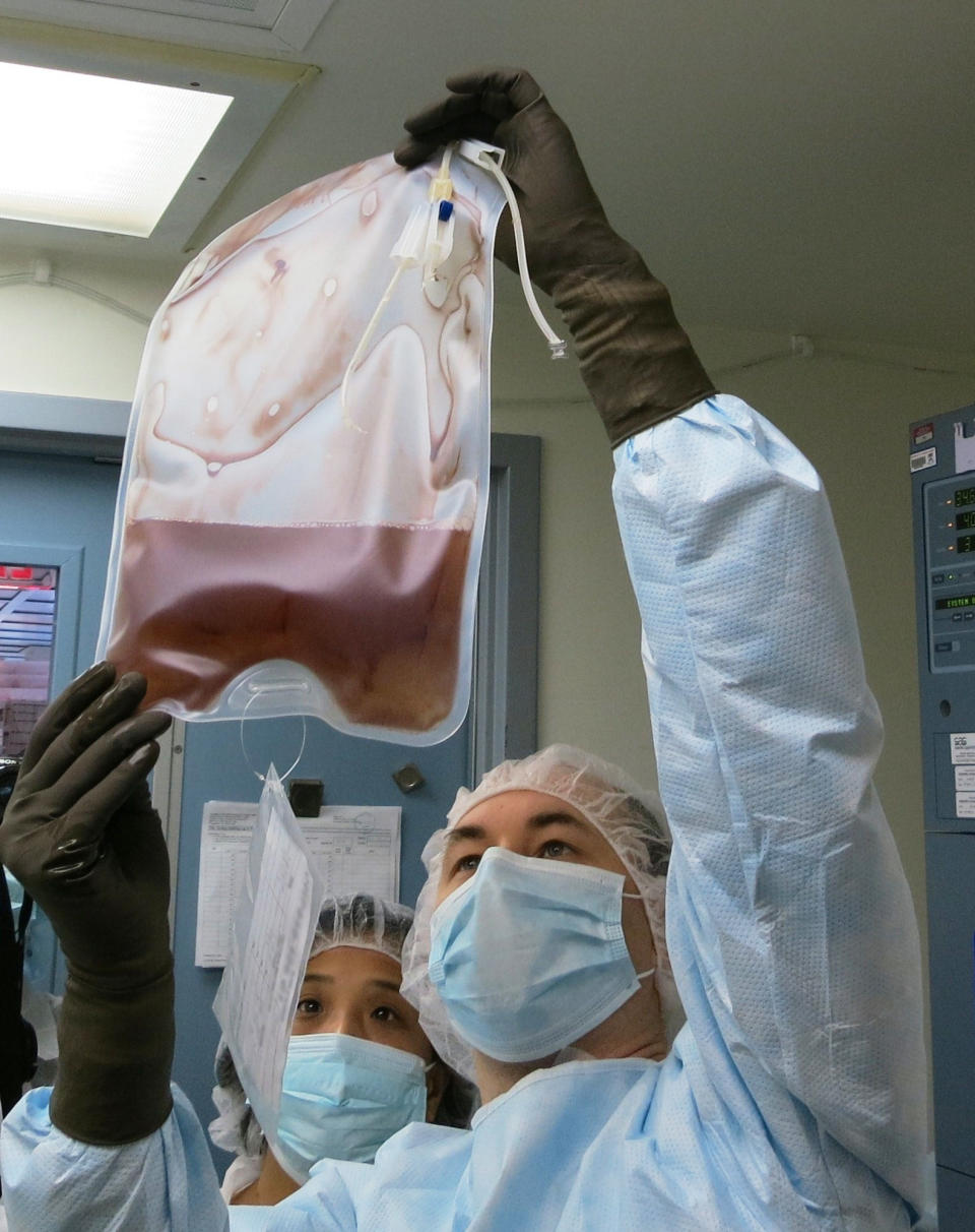 In this January 2013 photo provided by Penn Medicine, technicians in Penn Medicine’s Clinical Cell and Vaccine Production Facility in Philadelphia hold up a bag of modified T cells genetically modified to resist HIV infection. Scientists have modified genes in the blood cells of HIV patients to help them resist the AIDS virus, and say the treatment seems safe and promising. The results give hope that this approach might one day free at least some people from needing medicines to keep HIV under control. Results of the study at the University of Pennsylvania were published in the Thursday, March 6, 2014 issue of the New England Journal of Medicine. (AP Photo/Penn Medicine, Peggy Peterson Photography)