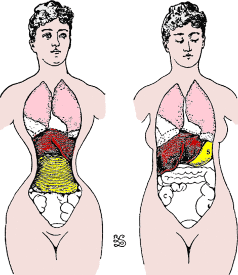 Health Benefits And Side Effects Of Wearing A Girdle - Health - Nigeria