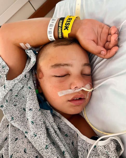 PHOTO: Easton Oliverson, known as 'Tank', a pitcher and outfielder for the Snow Canyon team out of Santa Clara, Utah, suffered an injury from a fall from a bunk bed, recovers from his injuries in Danville, Pa., Aug, 18. 2022. (Oliverson Family)