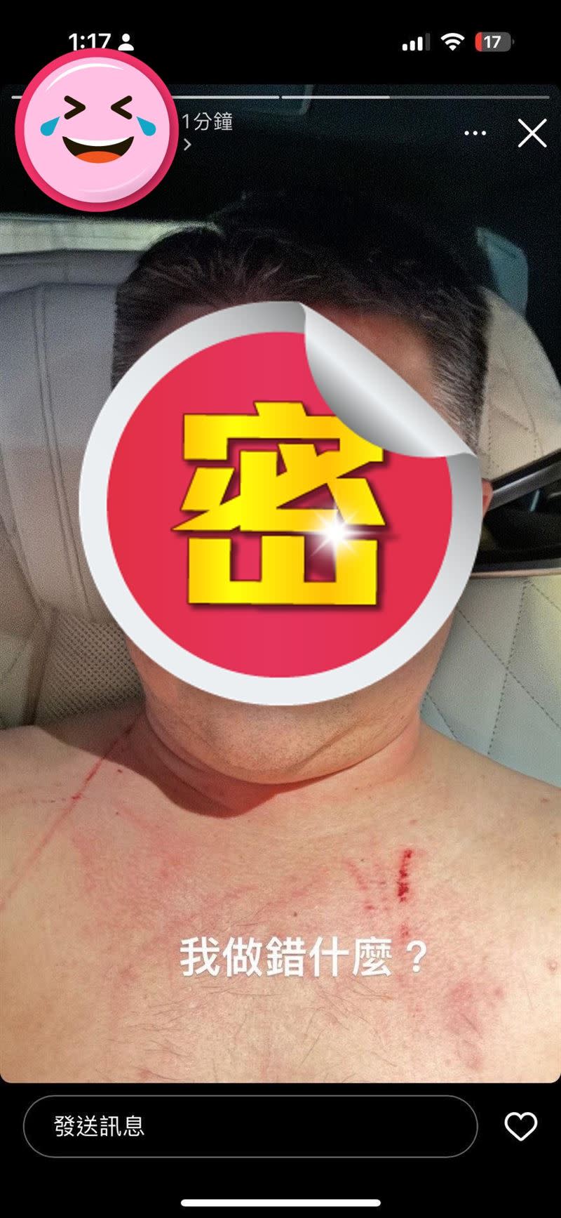 Kevin Kuo表示賴先生被林千又打到去台安醫院驗傷。（圖／Kevin Kuo提供）