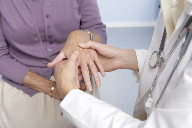 Rheumatoid arthritis. General practitioner examining a patient's hand for signs of rheumatoid arthritis. This condition is cause