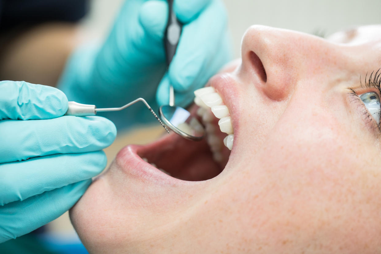 6,1% des rendez-vous chez le dentiste ne sont pas honorés par les patients (crédit : getty image).