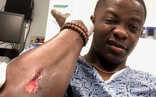 James Shaw displays the wound he suffered while tackling a gunman at a restaurant in Nashville, Tennessee - James Shaw
