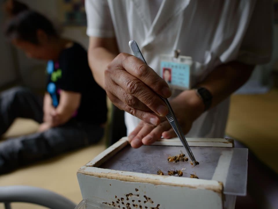 The woman had undergone bee acupuncture for two years before the tragedy occurred. Photo: Getty