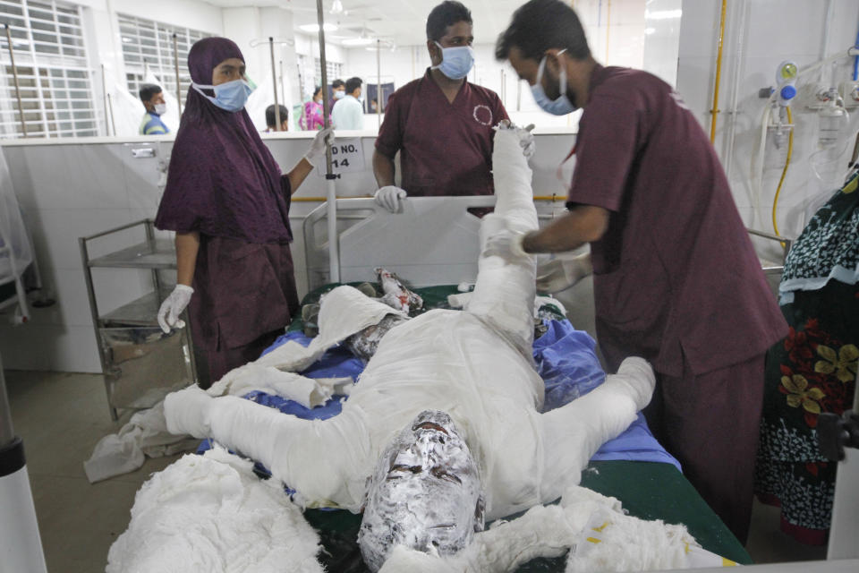 Doctors treat a burn Muslim worshipper in a hospital in Dhaka, Bangladesh, Saturday, Sept. 5, 2020. Dozens of Muslim worshipers suffered burn injuries critically during evening prayers after explosions of a gas pipeline installed underground near a mosque outside Bangladesh capital, officials said Saturday. (AP Photo/Abdul Goni)