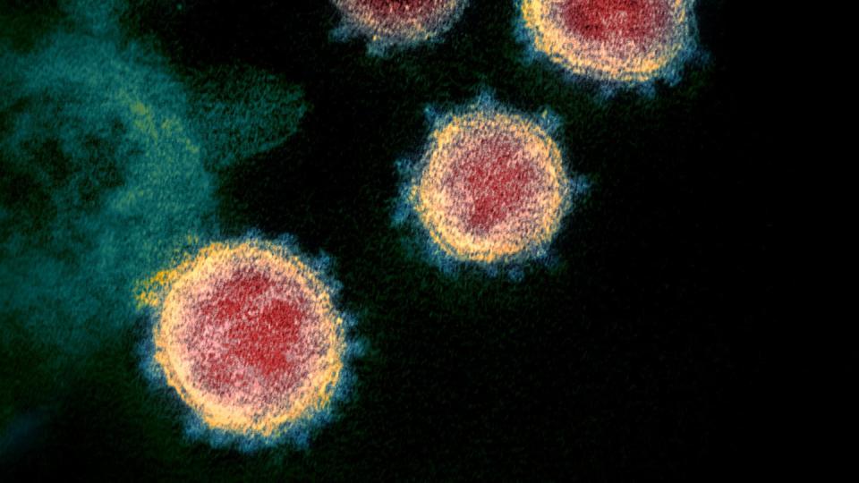 Diese elektronenmikroskopische Aufnahme des U.S. National Institutes of Health zeigt das neuartige Coronavirus (SARS-CoV-2), das Covid-19 verursacht.