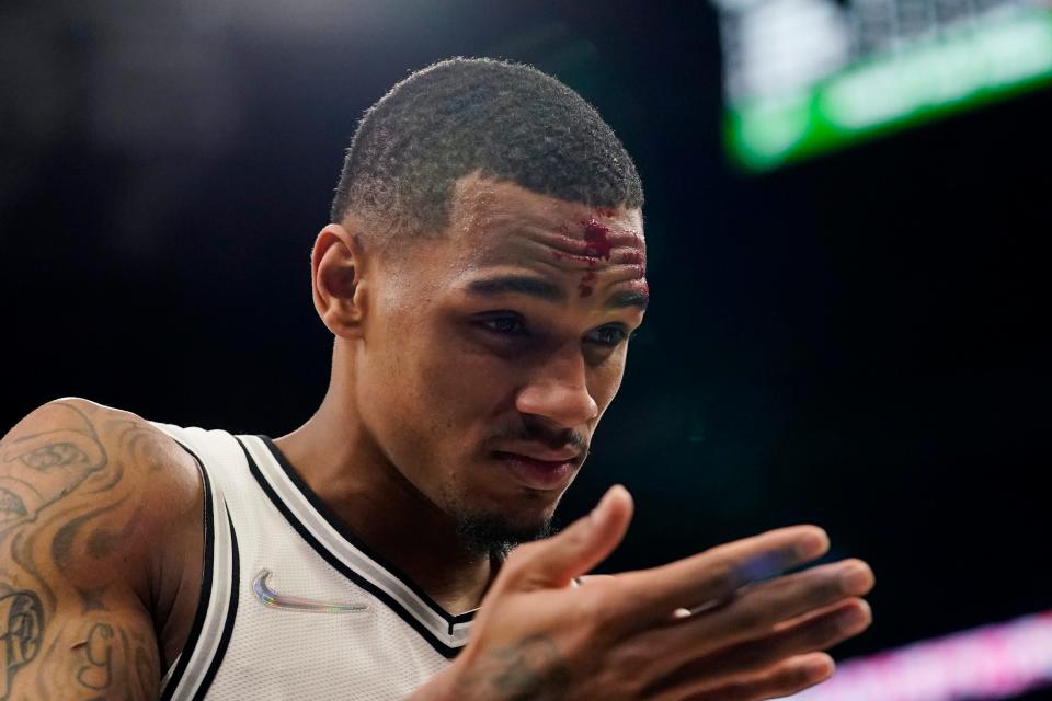 San Antonio Spurs guard Dejounte Murray walks off the court after he was hurt during the second half of the team's NBA basketball game against the Toronto Raptors, Wednesday, March 9, 2022, in San Antonio. (AP Photo/Eric Gay)