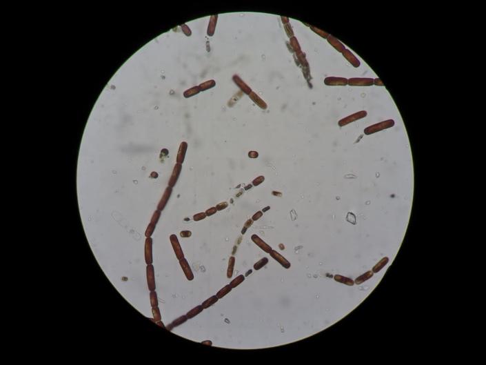 purple algae microscope image little filaments