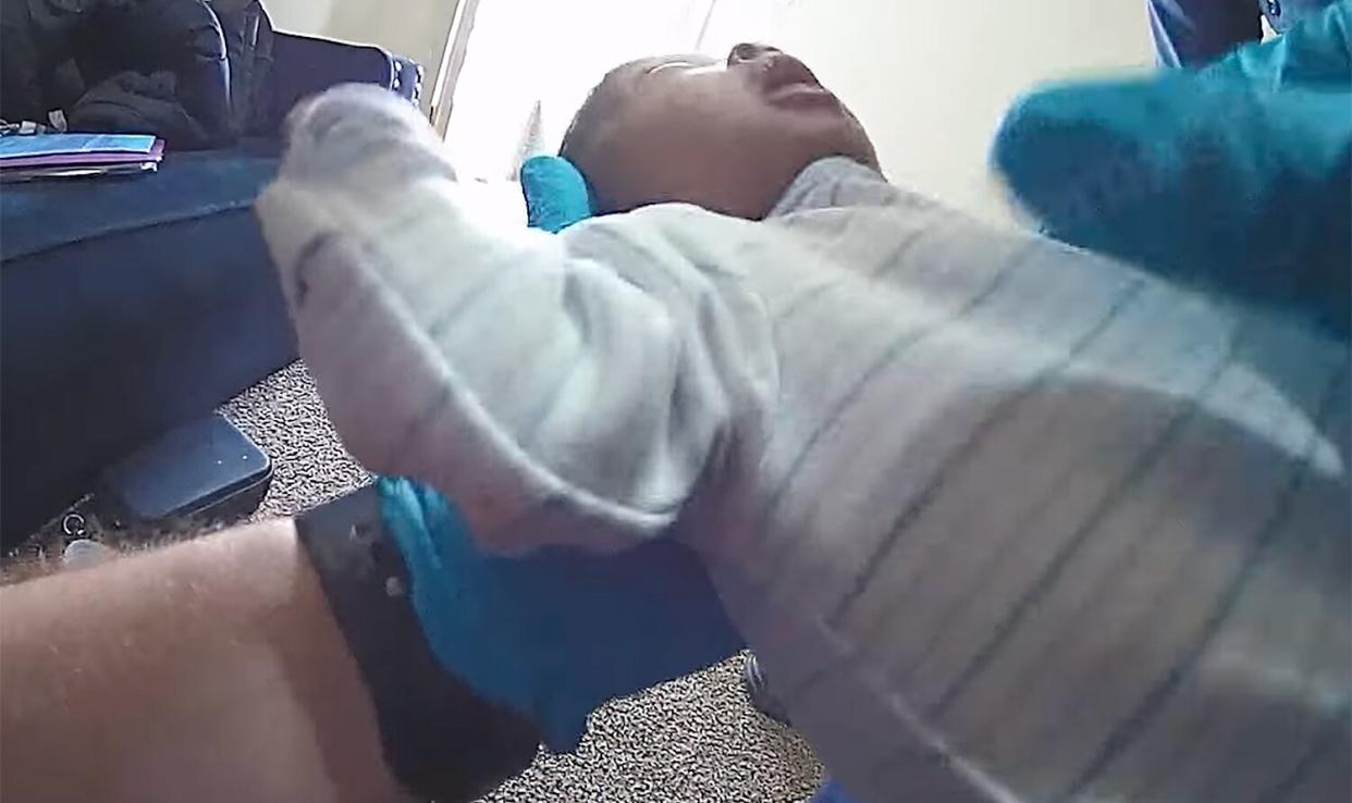 police save baby with RSV