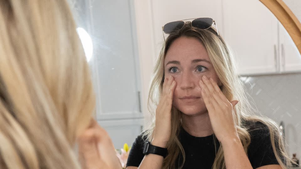 Brianna Starr applies sunscreen every day after her doctor found two precancerous moles during a routine skin check. - Courtesy Orlando Health Cancer Institute