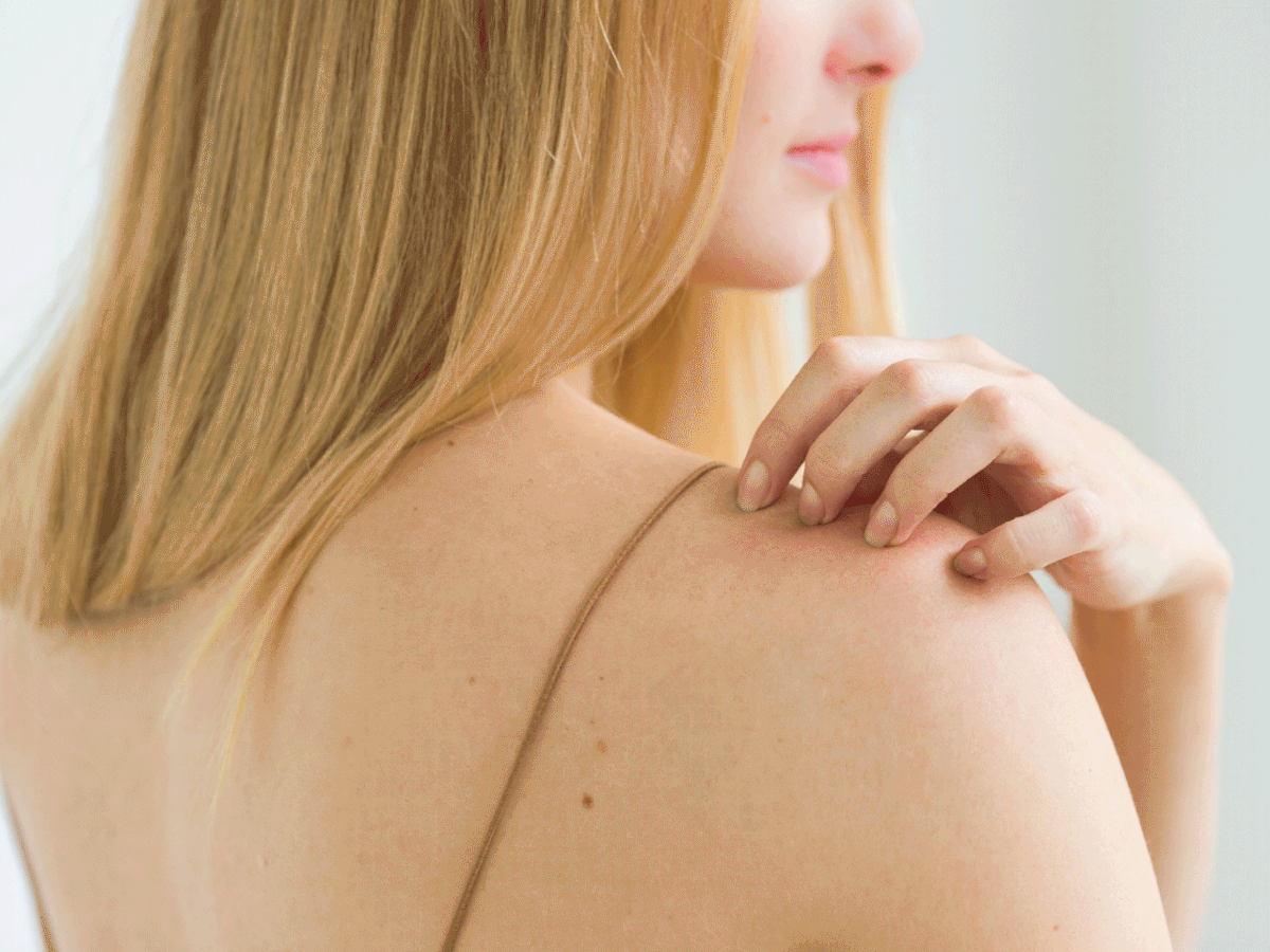 How To Tell The Difference Between Psoriasis And Eczema