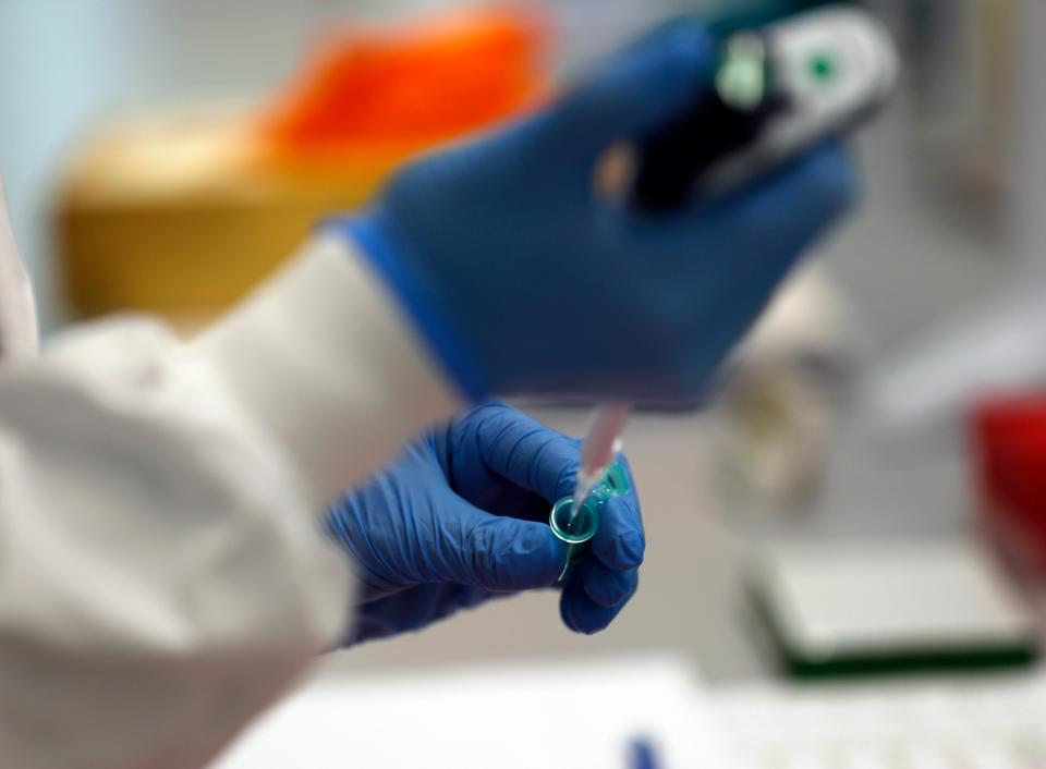 A lab assistant uses a pipette to prepare Coronavirus RNA for sequencing (AP)