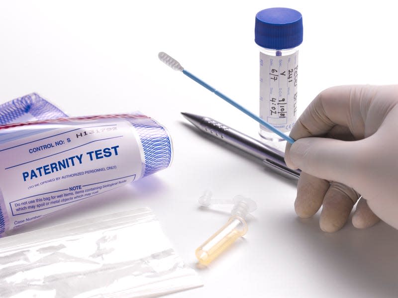 DNA swab for paternity test. - Photo: Peter Dazeley (Getty Images)