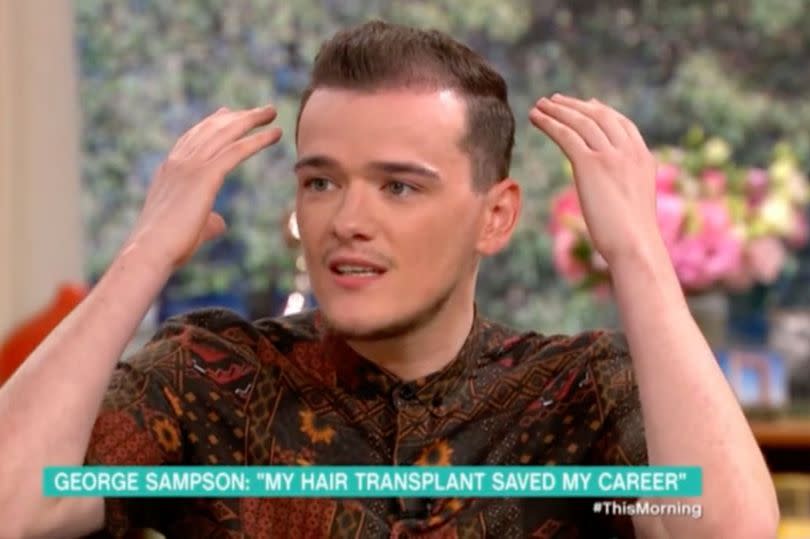 He previously opened up about his hair transplant ( Image: ITV) -Credit:ITV