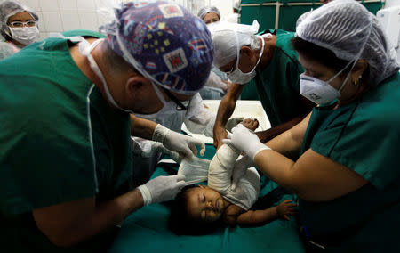 Doctors wrap a child's burnt skin with sterilised tilapia fish skin at Dr. Jose Frota Institute in the northeastern costal city of Fortaleza, Brazil, May 3, 2017. REUTERS/Paulo Whitaker