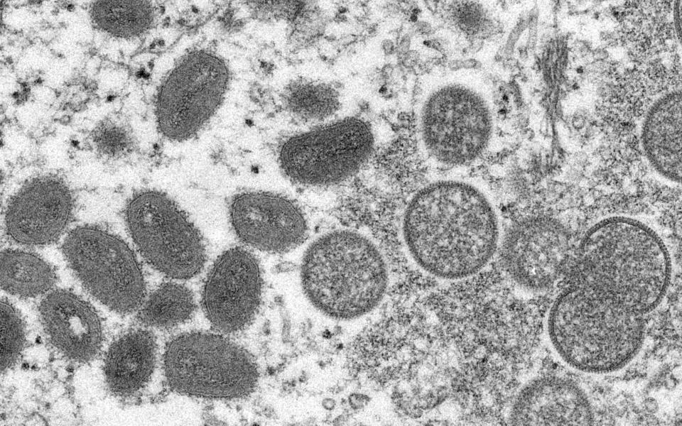 A electron microscope image of the monkeypox virus - Cynthia S. Goldsmith, Russell Regner/CDC via AP, File