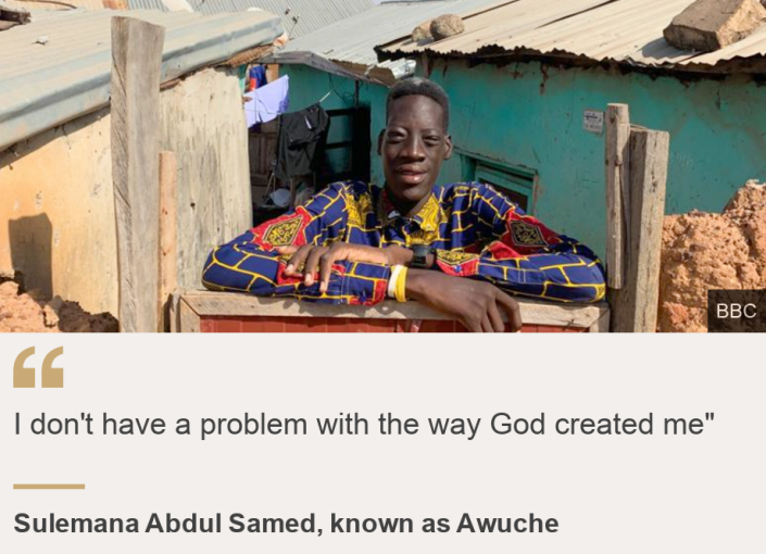 "  I have no problem with the way God created me "  ", Source: Suleiman Abdel Samad, known as Awuche, Source description:, Photo: Suleiman Abdel Samad, known as Awuche
