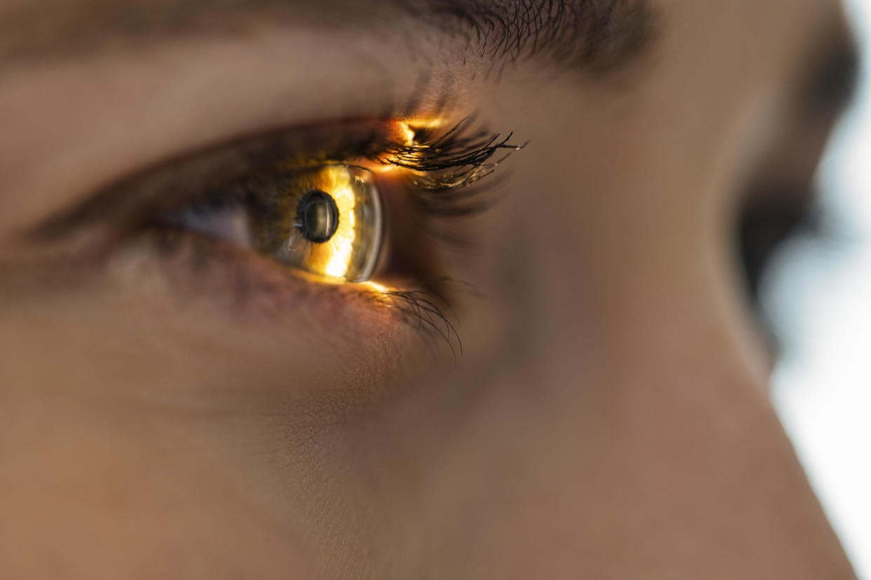 Aunque no se trata de enfermedades de la vista, estas afecciones impactan la calidad y salud de nuestros ojos. (Getty Creative)