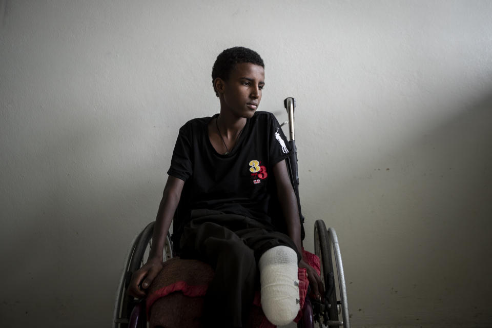 Mikiele Kahsay, 16, sits in a wheelchair at the Ayder Referral Hospital in Mekele, in the Tigray region of northern Ethiopia, on Thursday, May 6, 2021. The teenager was wounded when a shell landed near him as he was kicking a ball at a school field in Bizet. His leg had to be amputated because he was unable to get to hospital for four days, and gangrene set in. (AP Photo/Ben Curtis)