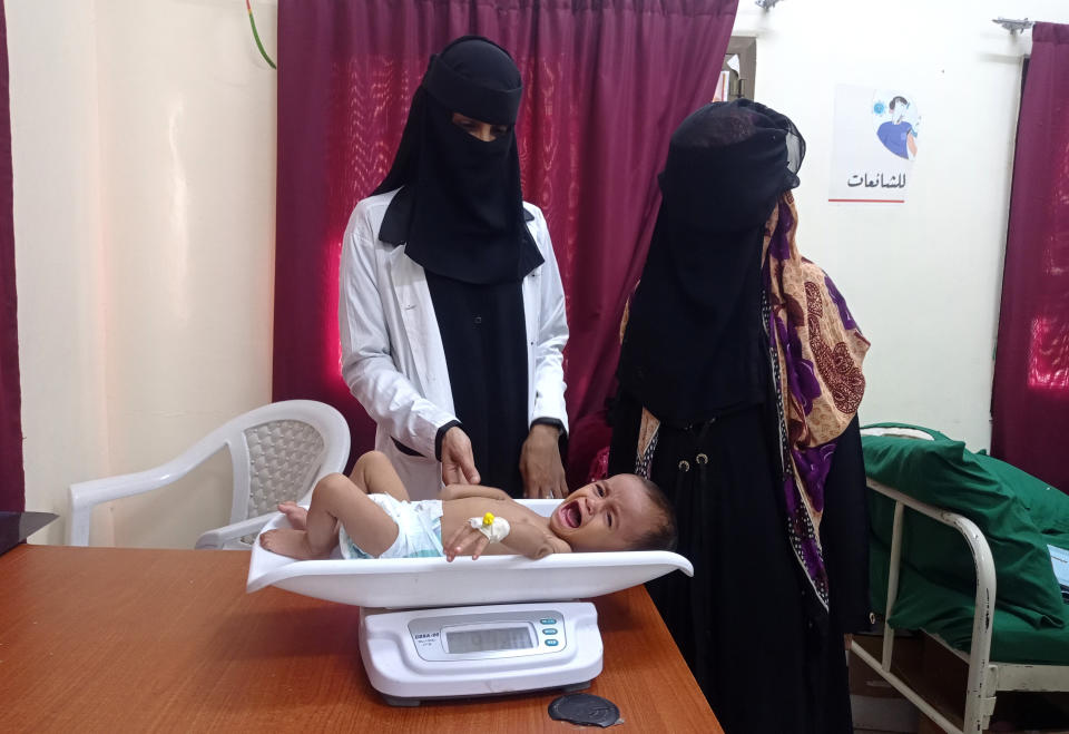 A malnourished boy is placed on a scale at Hays Rural Hospital in Hodeida, Yemen, Tuesday, Oct. 11, 2022. For years starvation has been an everyday threat for Yemen’s children. Now, as the war threatens to escalate between the country’s warring parties after months of a tenuous truce, there are fears that it could get worse. (AP Photo/Hussam Al-Bakry)