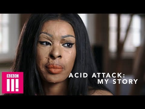 28) Acid Attack: My Story