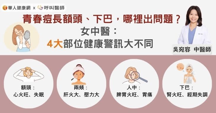 青春痘長額頭、下巴，哪裡出問題？女中醫：4大部位健康警訊大不同