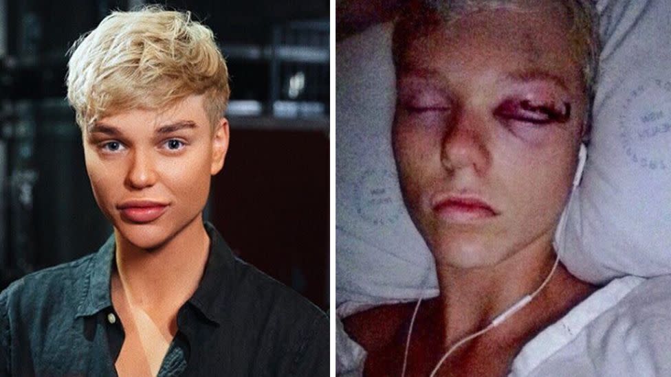 Former child star and Australia's Got Talent winner Jack Vidgen who will be on The Voice, had a brain tumour removed in 2011.