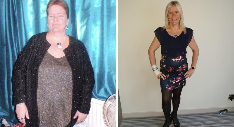 Lady sees 12st weight loss after occupying trampolining and also 'bouncing herself slim' - Yahoo Amusement