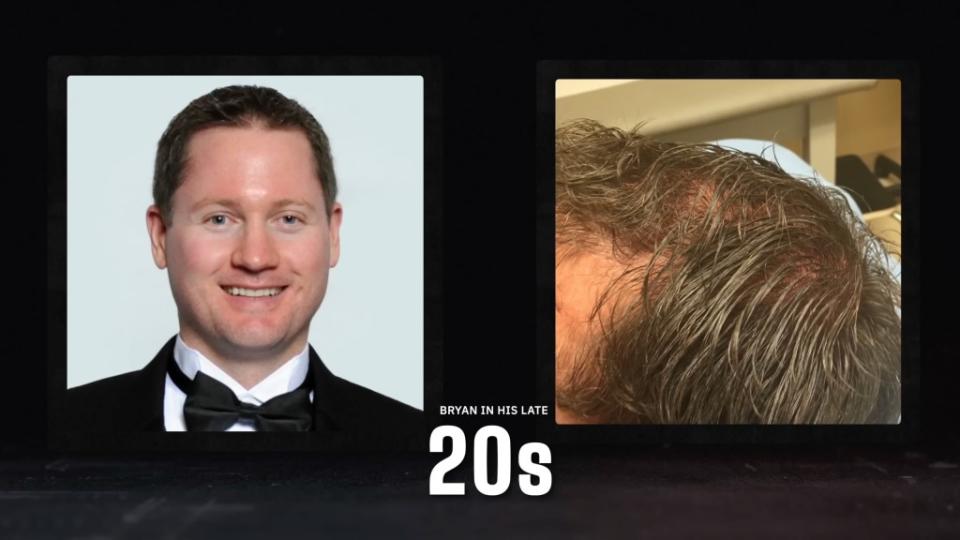 He said he’s come a long way since he started going gray in his 20s. Bryan Johnson/YouTube
