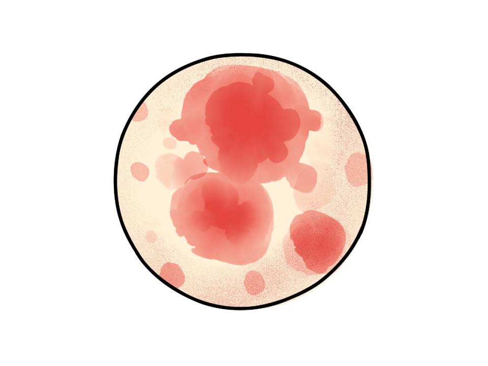 illustration of a close-up circle showing red blotchy skin