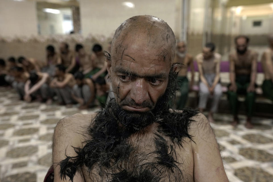 A drug addict detained during a Taliban raid is shaved at a drug treatment camp in Kabul, Afghanistan, Tuesday, May 31, 2022. Drug addiction has long been a problem in Afghanistan, the world’s biggest producer of opium and heroin. The ranks of the addicted have been fueled by persistent poverty and by decades of war that left few families unscarred. (AP Photo/Ebrahim Noroozi)