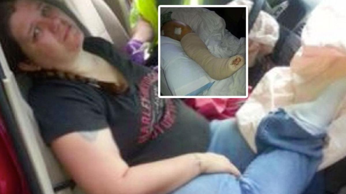 Woman warns 'never put your legs on the dashboard' after horrific