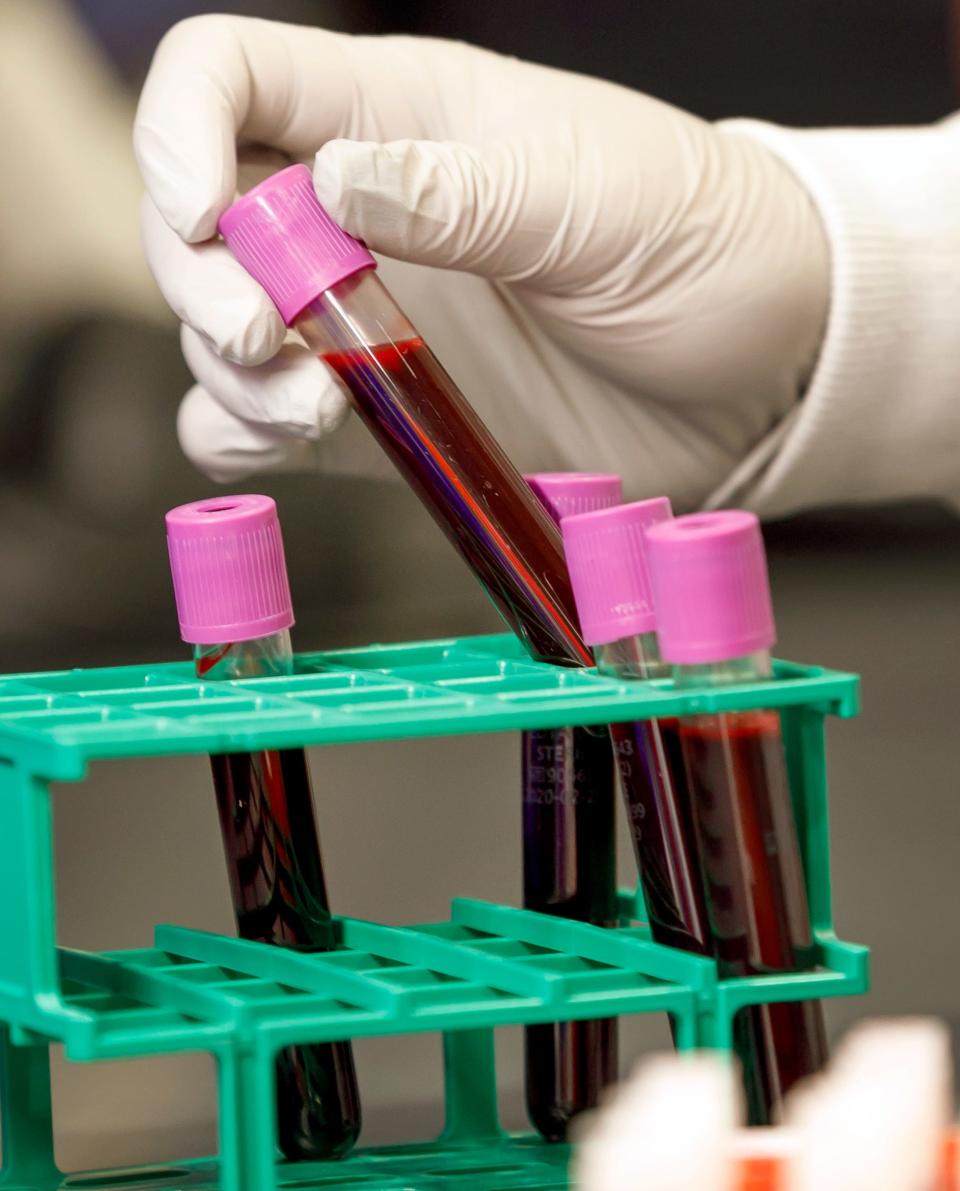Blood samples collected for the Pathfinder study at OHSU Knight Cancer Institute's Cancer Early Detection Advanced Research Center.