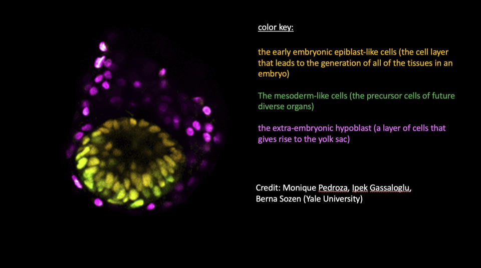 This graphic provided by Yale University shows an image of a human embryo model. (Monique Pedroza, Ipek Gassaloglu, Berna Sozen/Yale University via AP)