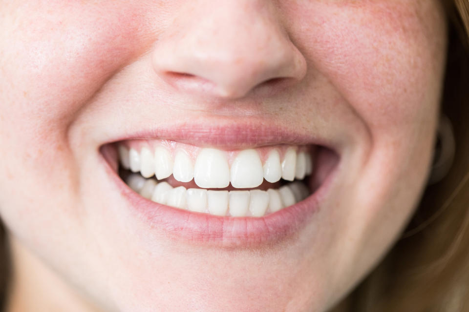 A great teeth-whitener on sale is definitely something to smile about. (Photo: Getty)