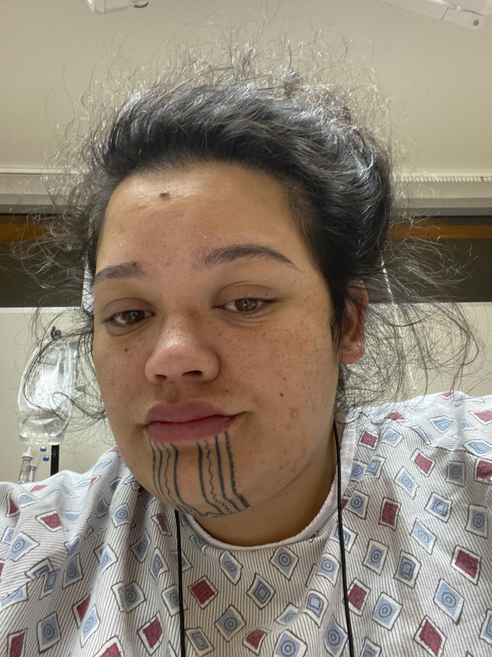 In this photo provided by Kuulei Perreira-Keawekane, she is seen in a selfie from her hospital bed on July 19, 2021, in Hilo, Hawaii. She tested positive for COVID-19, adding to the crisis that Hawaii is experiencing as hospitals are overflowing with a record number of patients, vaccinations are stagnating and Native Hawaiians suffering a disproportionate share of the suffering. (Kuulei Perreira-Keawekane via AP)