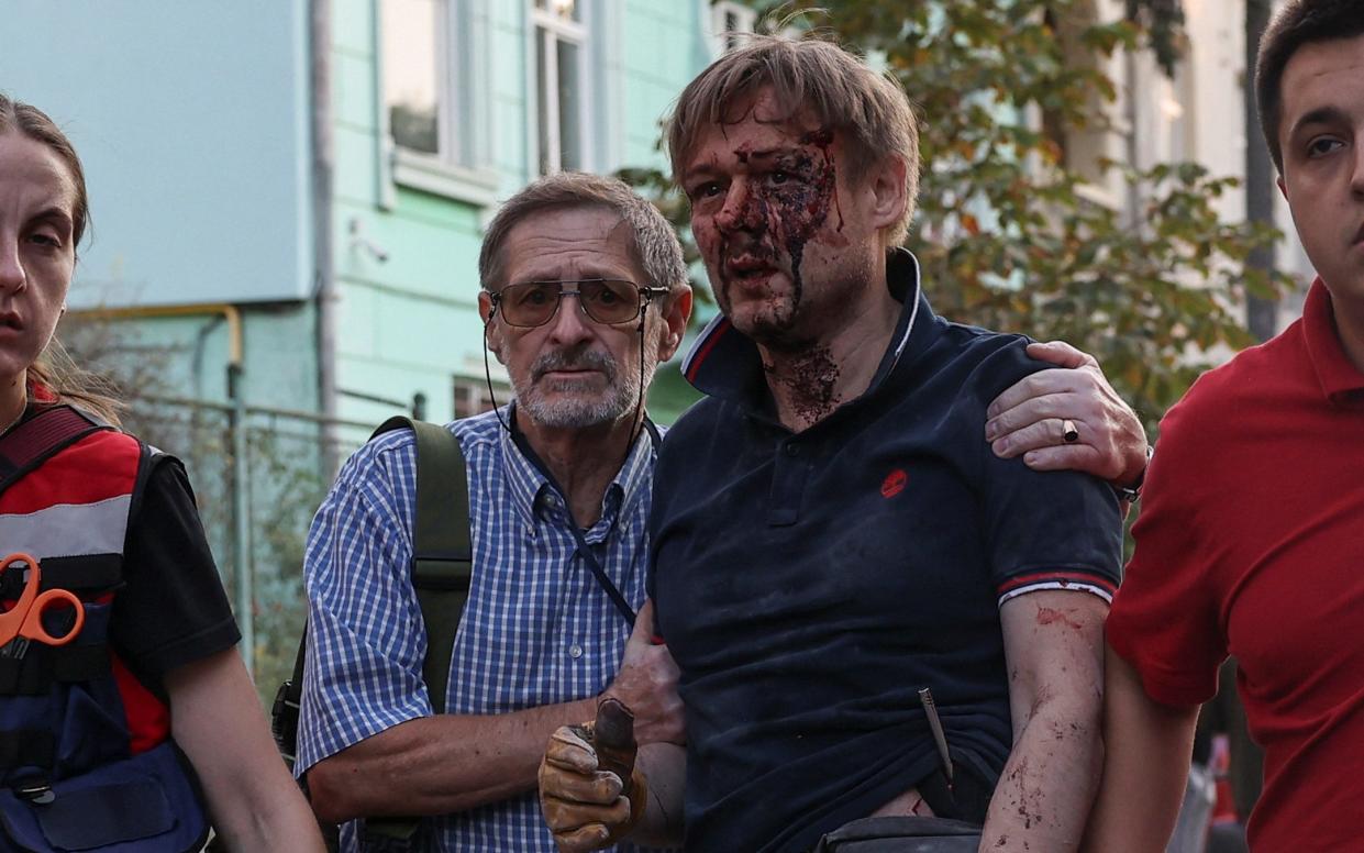 A bloodied Yaroslav Bazylevych is led from his home by rescue workers