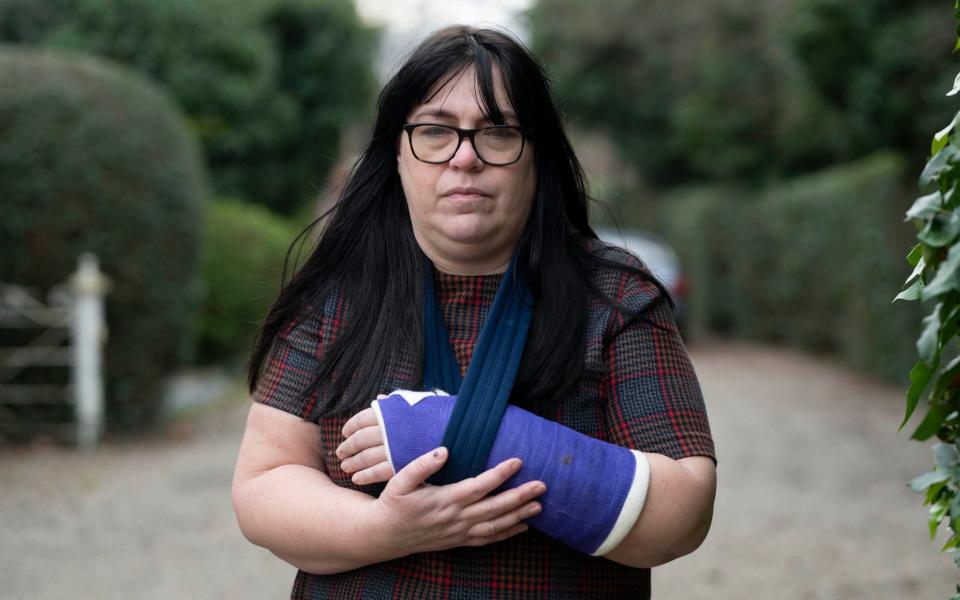 Emma Fairweather, who broke her wrist in the accident - SUNDAY MIRROR