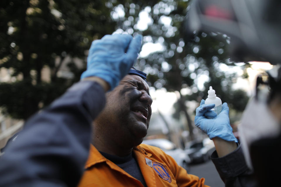 A civil defense worker grimaces as Angels of the Road paramedic volunteer Zully Rodiz applies drops on his eyes after a car fire at a parking lot in Caracas, Venezuela, Monday, Feb. 8, 2021. Rodiz is trained as an architect and earns a living managing social media websites. She has picked up first aid basics through courses and on‑the‑job learning. (AP Photo/Ariana Cubillos)