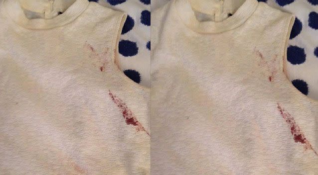 The blood stained top that Isobel wore to the concert. Source: Facebook.