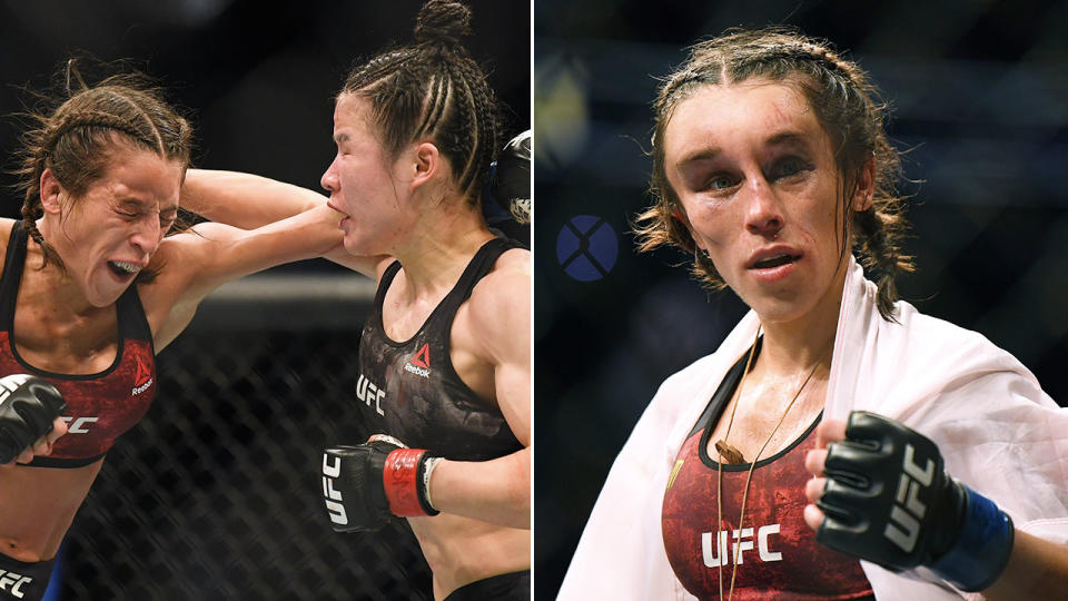 Pictured here, the gruesome aftermath to Joanna Jedrzejczyk's strawweight title fight at UFC 248.