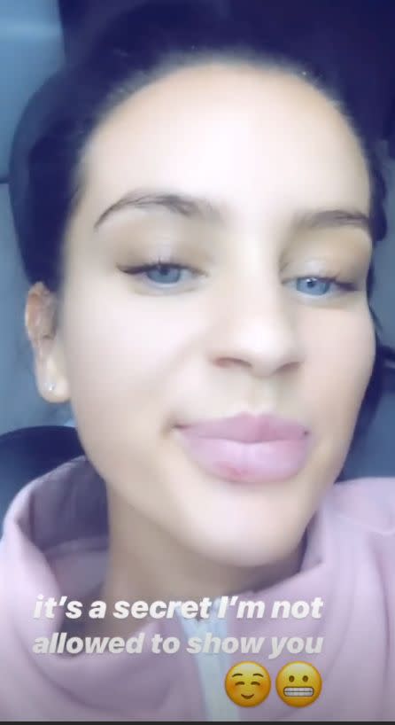 Earlier in the day, the 29-year-old reality star teased fans by claiming she wasn’t able to show them her ‘secret’ teeth transformation on her own Instagram account. Photo: Instagram/innnnnnes