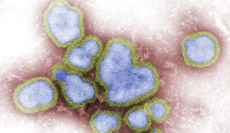 The Centers for Disease Control and Prevention and the U.S. Geological Survey monitor the various strains of the avian influenza flu viruses that can develop. This is a digitally-colorized, negative-stained transmission electron micrograph of the viruses.