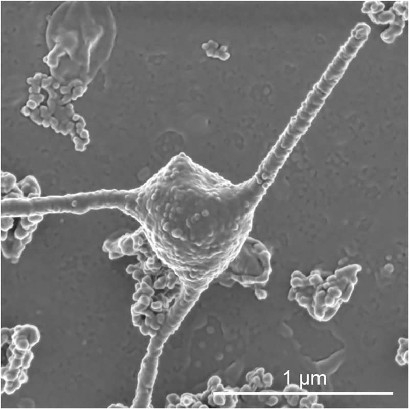 A scanning electron microscopy image of the single-celled organism Prometheoarchaeum syntrophicum strain MK-D1