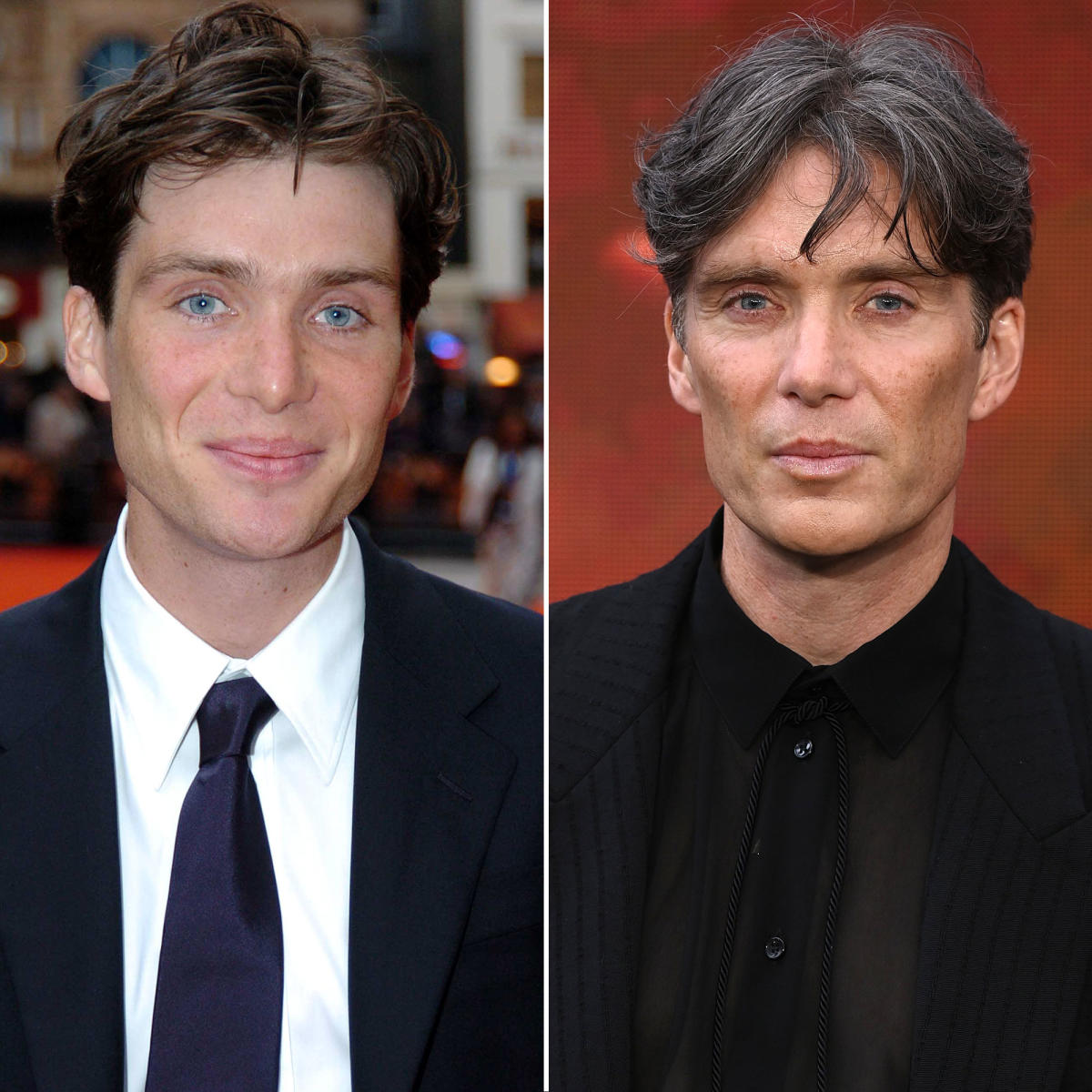 Has Cillian Murphy Had Plastic Surgery? See ‘Oppenheimer’ Star’s ...