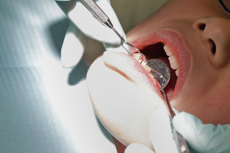 FILE - In this Friday, Jan. 22, 2016 photo, a dentist checks the teeth of a patient in Indianapolis. On Friday, April 21, 2023, The Associated Press reported on stories circulating online incorrectly claiming the No. 1 cause of heart attacks is a tooth treated for a root canal. (AP Photo/Michael Conroy, File)